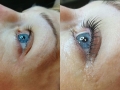 lashlift