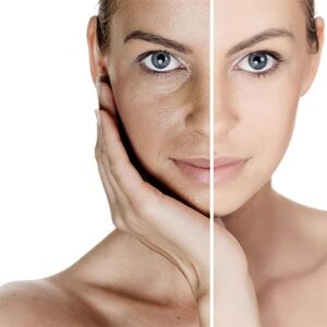 derma-roller-treatment-review